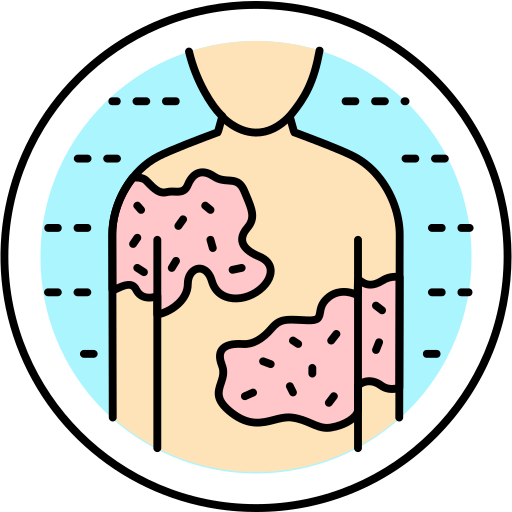 Best Treatment at Pune for Skin Diseases - Psoriasis, Eczema, Lichen Planus