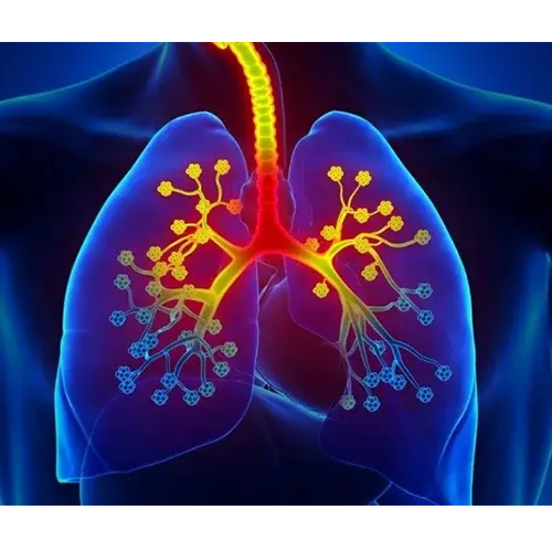 best Asthma Treatment