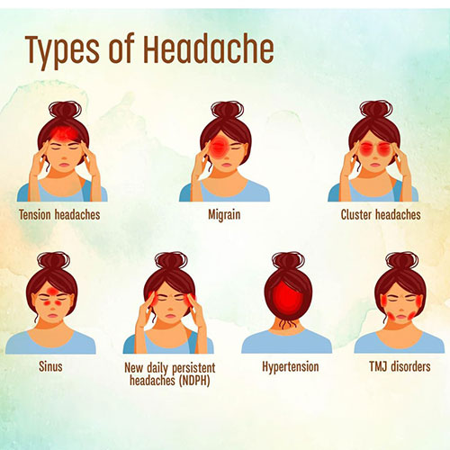 best Migraine Treatment